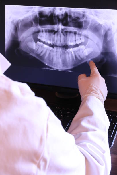 Best Emergency Treatment for Dental Infections or Abscesses in Springfield, MO