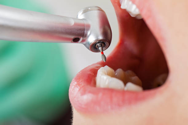 Best Emergency Gum Treatment in Springfield, MO